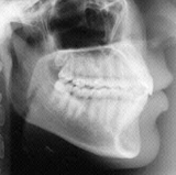 Radiologia Odontológica em Rio Branco